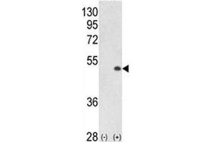 Western blot analysis of PCTAIRE1 antibody and 293 cell lysate (2 ug/lane) either nontransfected (Lane 1) or transiently transfected with the PCTK1 gene (2).