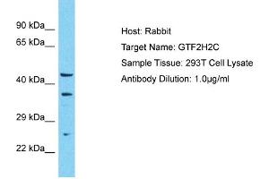 Host: Rabbit Target Name: GTF2H2C Sample Type: 293T Whole Cell lysates Antibody Dilution: 1.