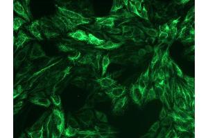 Immunocytochemistry staining of cytokeratin 8 in Hep-2 cells using mouse monoclonal antibody C-51 ((ABIN94298), diluted 1:200), detected with GAM IgG-Alexa Fluor488 (diluted 1:100, green). (KRT8 antibody)