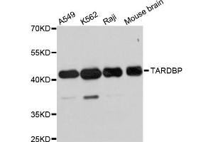 Western blot analysis of extracts of various cell lines, using TARDBP antibody (ABIN5999467) at 1/1000 dilution. (TARDBP antibody)