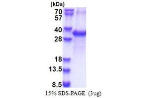 SDS-PAGE (SDS) image for Acyl-CoA Thioesterase 11 (ACOT11) (AA 19-250) protein (His tag) (ABIN5853381)