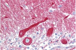 Immunohistochemistry with Brain, cerebellum tissue at an antibody concentration of 5µg/ml using anti-CPE antibody (ARP58445_P050) (CPE antibody  (N-Term))