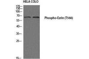 Western Blot (WB) analysis of HeLa COLO205 using Phospho-Ezrin (T566) antibody. (Ezrin antibody  (pThr566))