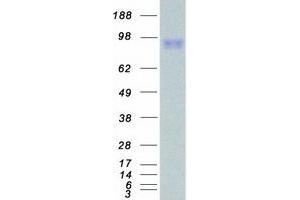 Validation with Western Blot