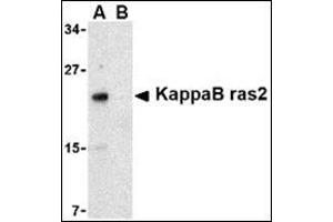 Western blot analysis of KappaB ras2 in RAW264. (NKIRAS2 antibody  (C-Term))