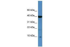 WB Suggested Anti-SPINK6 Antibody Titration: 0. (SPINK6 antibody  (Middle Region))