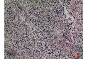 Immunohistochemistry (IHC) analysis of paraffin-embedded Human Brain, antibody was diluted at 1:100. (HDC antibody  (Internal Region))