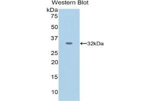 Detection of Recombinant NES, Human using Monoclonal Antibody to Nestin (NES) (Nestin antibody  (AA 178-399))