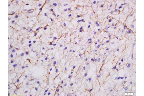MDGA2 antibody  (AA 751-850)