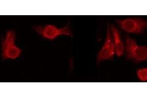 ABIN6275655 staining 293 by IF/ICC. (USP38 antibody  (Internal Region))
