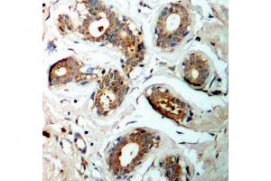 Immunohistochemistry (IHC) image for anti-14-3-3 zeta (YWHAZ) (pSer58) antibody (ABIN3019773)