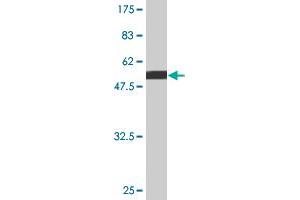 Western Blot detection against Immunogen (50. (PPP2R3B antibody  (AA 1-225))