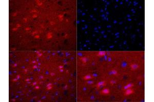Formalin-fixed and paraffin embedded rat brain labeled with Rabbit Anti-Bax (Ser184) Polyclonal Antibody, Unconjugated used at 1:200 dilution for 40 minutes at 37°C. (BAX antibody  (pSer184))