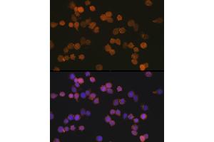 Immunofluorescence analysis of THP-1 cells using //IB Rabbit mAb (9776) at dilution of 1:100 (40x lens). (Iba1 antibody)
