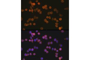 Immunofluorescence analysis of THP-1 cells using //IB Rabbit mAb (9776) at dilution of 1:100 (40x lens). (Iba1 antibody)