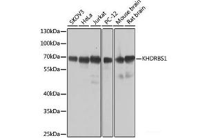 Western blot analysis of extracts of various cell lines using KHDRBS1 Polyclonal Antibody at dilution of 1:1000. (KHDRBS1 antibody)