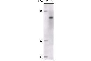 Western blot analysis using FES mouse mAb against truncated FES recombinant protein. (FES antibody)
