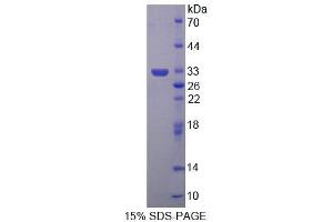 SDS-PAGE analysis of Human ABAT Protein. (ABAT Protein)