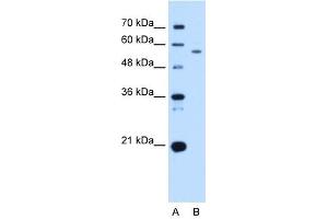 Western Blot showing UBXD2 antibody used at a concentration of 2. (UBXD2 antibody  (Middle Region))