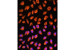 Immunofluorescence analysis of L929 cells using LMBRD1 Rabbit pAb (ABIN7268291) at dilution of 1:100. (LMBRD1 antibody  (AA 220-300))