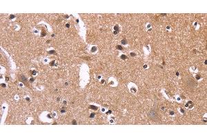 Immunohistochemistry of paraffin-embedded Human brain tissue using SELPLG Polyclonal Antibody at dilution 1:50 (SELPLG antibody)