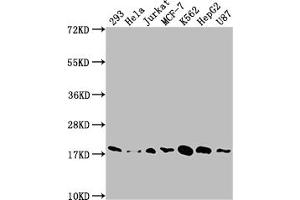Western Blot Positive WB detected in: 293 whole cell lysate, Hela whole cell lysate, Jurkat whole cell lysate, MCF-7 whole cell lysate, K562 whole cell lysate, HepG2 whole cell lysate, U87 whole cell lysate All lanes: SOD1 antibody at 1:1500 Secondary Goat polyclonal to rabbit IgG at 1/50000 dilution Predicted band size: 16 kDa Observed band size: 18 kDa (Recombinant SOD1 antibody)