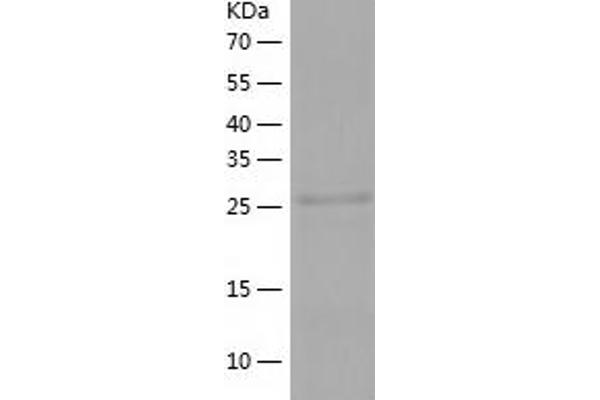 HERPUD1 Protein (AA 1-263) (His tag)