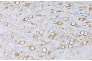 Immunohistochemistry of paraffin-embedded Mouse brain using MYH10 Polyclonal Antibody at dilution of 1:100 (40x lens). (MYH10 antibody)