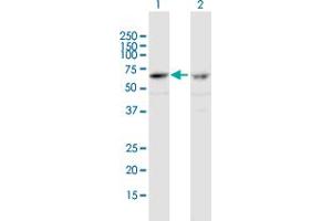 Western Blot analysis of ZNF284 expression in transfected 293T cell line by ZNF284 MaxPab polyclonal antibody. (ZNF284 antibody  (AA 1-593))