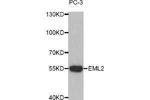 Western blot analysis of extracts of PC-3 cells, using EML2 antibody (ABIN5972622). (EML2 antibody)