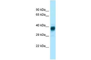WB Suggested Anti-Olfr329-ps Antibody Titration: 1. (OLFR329-PS antibody  (Middle Region))