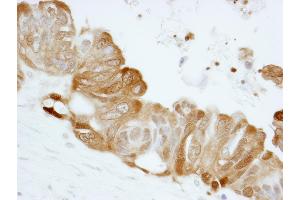Immunohistochemistry (IHC) image for anti-Stratifin (SFN) (AA 198-248) antibody (ABIN7448925) (14-3-3 sigma/SFN antibody  (AA 198-248))