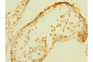 Immunohistochemistry (IHC) image for anti-Membrane Protein, Palmitoylated 6 (MAGUK P55 Subfamily Member 6) (MPP6) (AA 220-420) antibody (ABIN7158909)