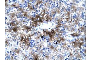 Image no. 1 for anti-Protein Inhibitor of Activated STAT, 3 (PIAS3) (AA 548-597) antibody (ABIN202823) (PIAS3 antibody  (AA 548-597))