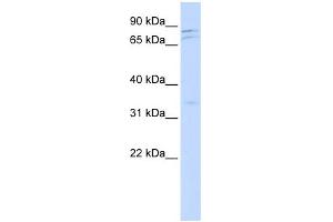 WB Suggested Anti-NEK11 Antibody Titration:  0. (NEK11 antibody  (Middle Region))