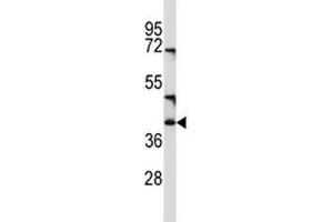 CD1c antibody western blot analysis in NCI-H460 lysate (CD1c antibody  (AA 226-253))