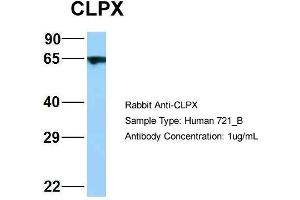 Host: Rabbit Target Name: WT1 Sample Type: 721_B Antibody Dilution: 1. (CLPX antibody  (C-Term))