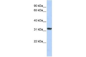 SMNDC1 antibody used at 1 ug/ml to detect target protein. (SMNDC1 antibody  (C-Term))