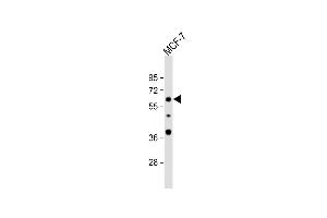 Anti-EX2 Antibody (Center) at 1:1000 dilution + MCF-7 whole cell lysate Lysates/proteins at 20 μg per lane. (APEX2 antibody  (AA 143-171))