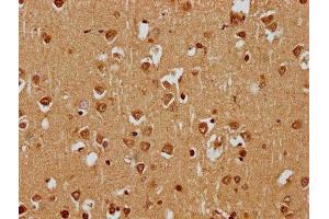 SKOR1 antibody  (AA 744-965)