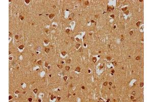 IHC image of ABIN7169769 diluted at 1:400 and staining in paraffin-embedded human brain tissue performed on a Leica BondTM system. (SKOR1 antibody  (AA 744-965))