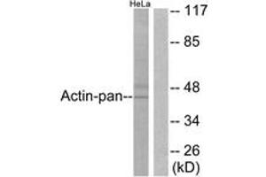 Western blot analysis of extracts from HeLa cells, using Actin-pan Antibody. (Actin antibody  (AA 326-375))