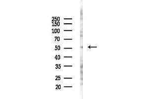anti-Vitamin K-dependent protein C (PROC) (Internal Region) antibody