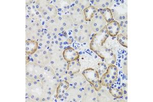 Immunohistochemistry of paraffin-embedded mouse kidney using MTERFD3 antibody. (MTERFD3 antibody)