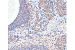 Immunohistochemistry of paraffin-embedded Rat ovary using TES Polyclonal Antibody at dilution of 1:100 (40x lens). (TES antibody)