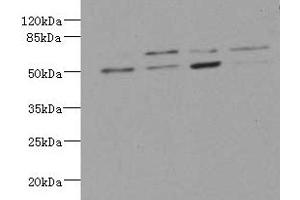 Western blot All lanes: LDB3 antibody at 3.