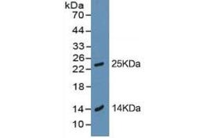 Rabbit Capture antibody from the kit in WB with Positive Control: BXPC-3 cell lysate. (Trypsin ELISA Kit)
