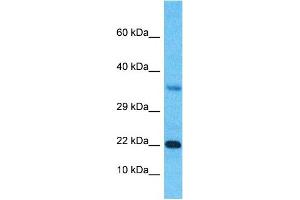 Host:  Rabbit  Target Name:  SSX3  Sample Type:  Fetal Kidney lysates  Antibody Dilution:  1. (SSX3 antibody  (Middle Region))