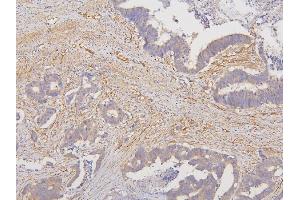 IHC analysis of RAB3GAP2 using anti-RAB3GAP2 antibody (ABIN6719633).