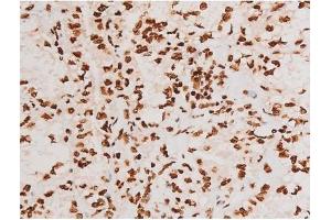 Immunohistochemistry (IHC) image for anti-REL proto-oncogene (c-Rel) (pSer503) antibody (ABIN6255382)